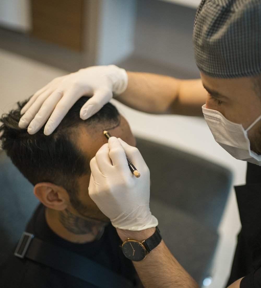 Hair Transplant Procedure